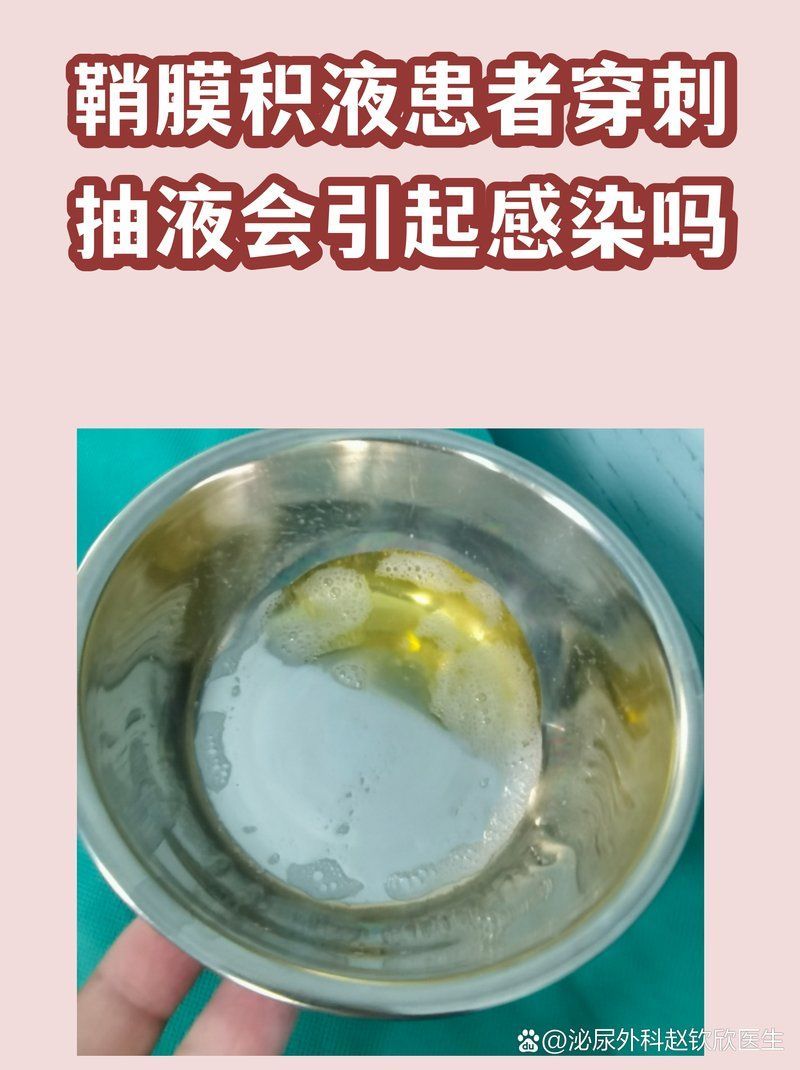 擠壓或穿刺排液有哪些風(fēng)險，擠壓或穿刺排液有哪些風(fēng)險擠壓或穿刺排液有哪些風(fēng)險