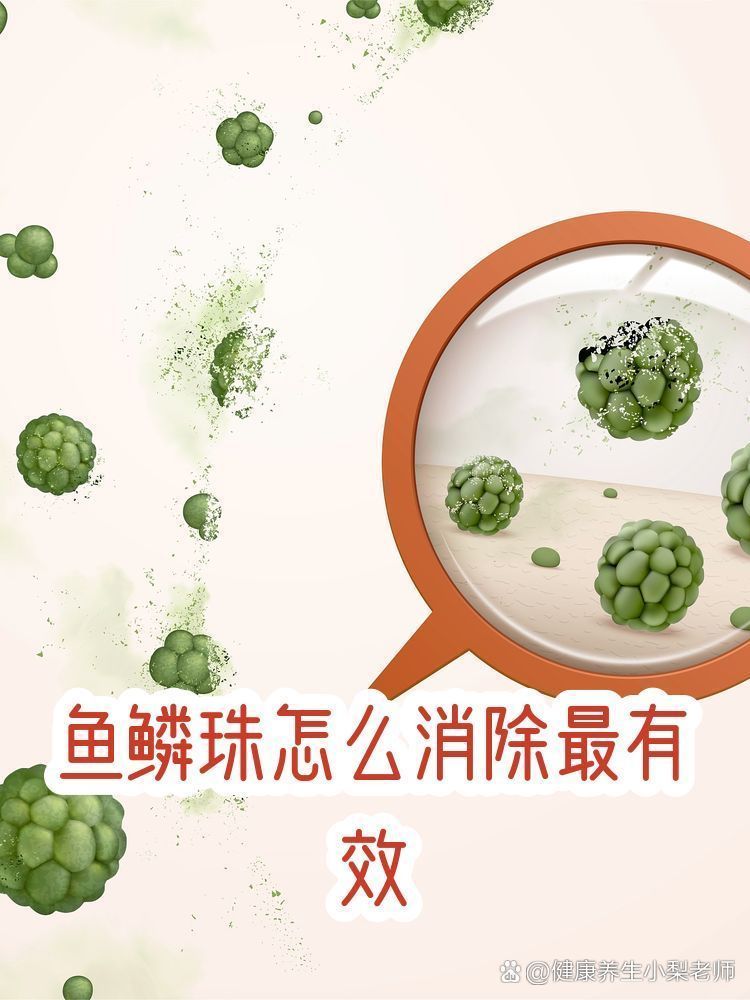 哪種方法去除魚鱗珠最快，哪種方法去除魚鱗珠最快本探討了快速去除魚鱗珠的方法