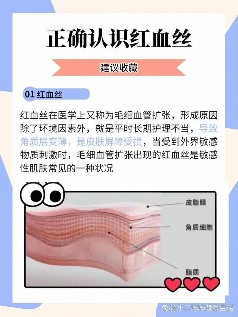 如何判斷自己的紅血絲類型，如何判斷自己的紅血絲類型，如何區分單純毛細血管擴張和疾病伴隨型