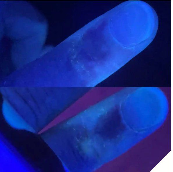 如何預防和治療皮膚癬菌病，關于皮膚癬菌病治療的一些建議