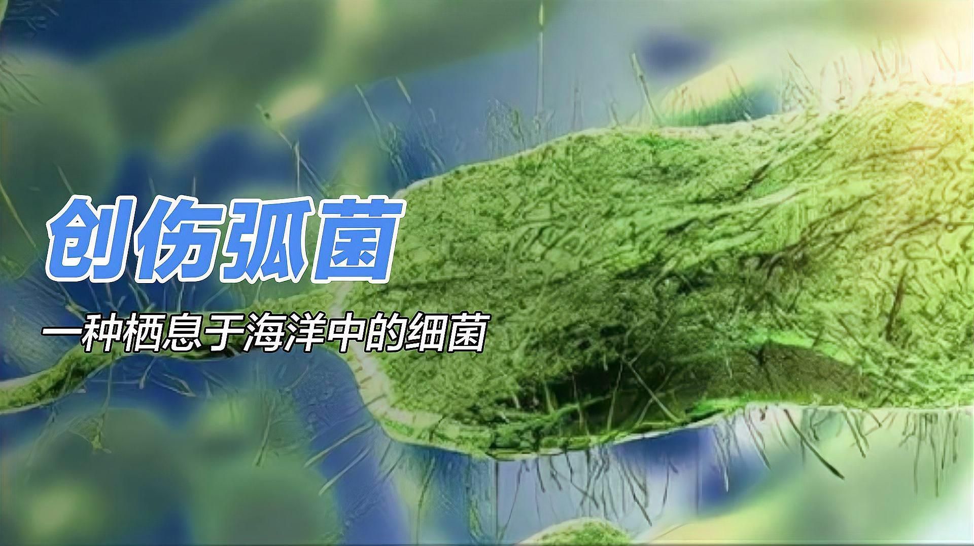 海水細菌感染的潛伏期是多久，海水細菌感染的潛伏期