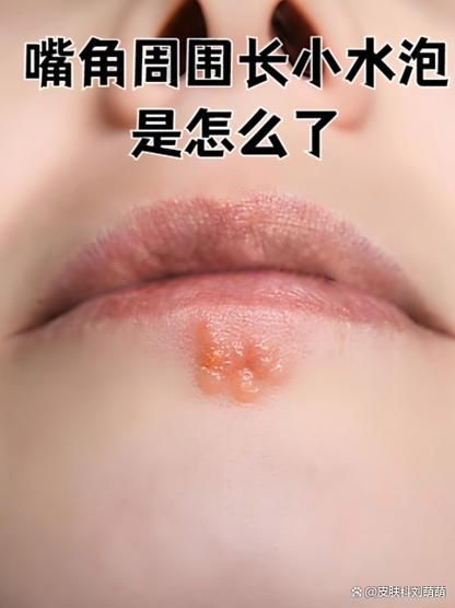 哪些藥物對龍魚嘴角長疙瘩最有效？，龍魚嘴角長疙瘩怎么辦