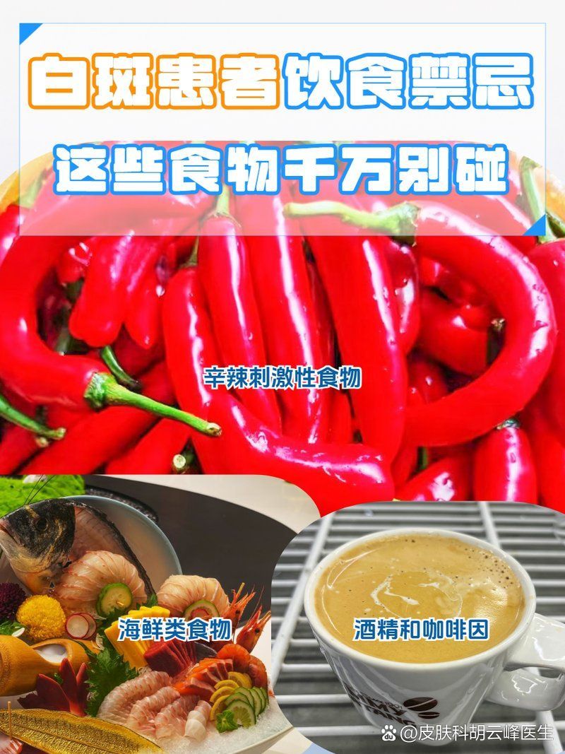 白點病治療期間需要忌口嗎，白點病治療期間需要忌口嗎，白斑患者忌吃什么要注意什么
