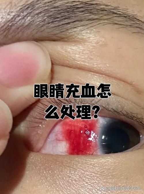 請(qǐng)?zhí)峁┎煌瑖?yán)重程度的充血圖片，如何預(yù)防迷你鸚鵡魚(yú)鰭根部充血？