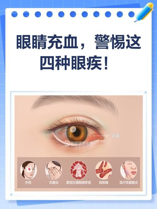 請(qǐng)?zhí)峁┎煌瑖?yán)重程度的充血圖片，如何預(yù)防迷你鸚鵡魚(yú)鰭根部充血？