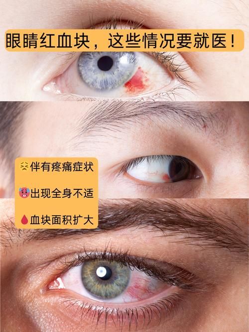 請(qǐng)?zhí)峁┎煌瑖?yán)重程度的充血圖片，如何預(yù)防迷你鸚鵡魚(yú)鰭根部充血？