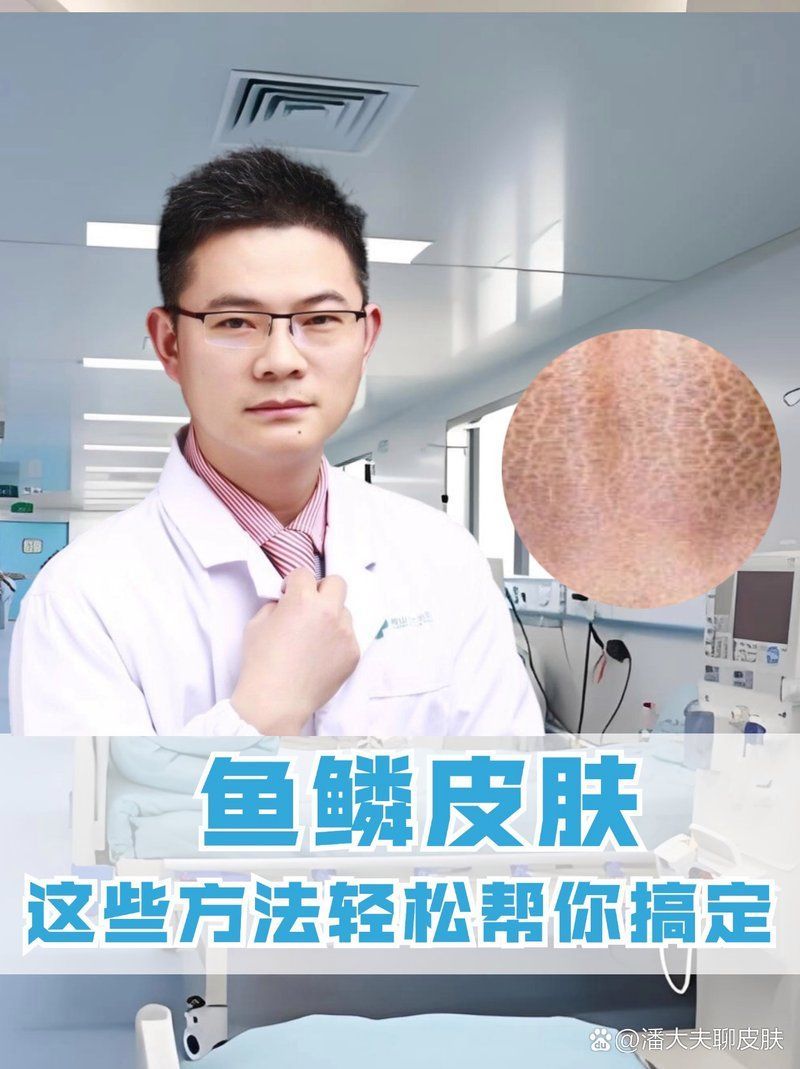 手上長魚鱗怎么去除掉