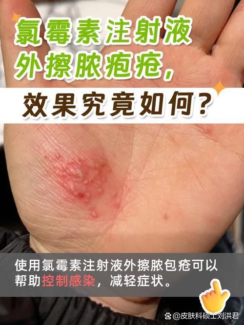 如何區(qū)分龍魚的正常增生和疾病？，如何區(qū)分龍魚正常增生與疾病性增生與疾病性增生形態(tài)