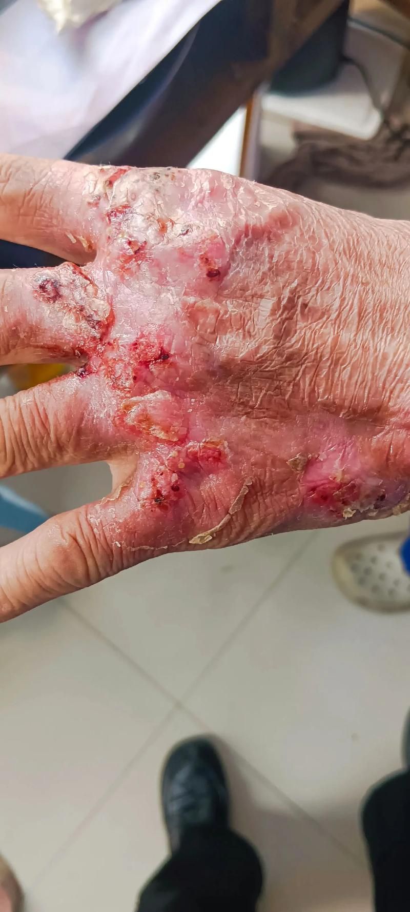 如何判斷龍魚胡子是否齊根斷?,如何判斷龍魚胡子是否“齊根斷”