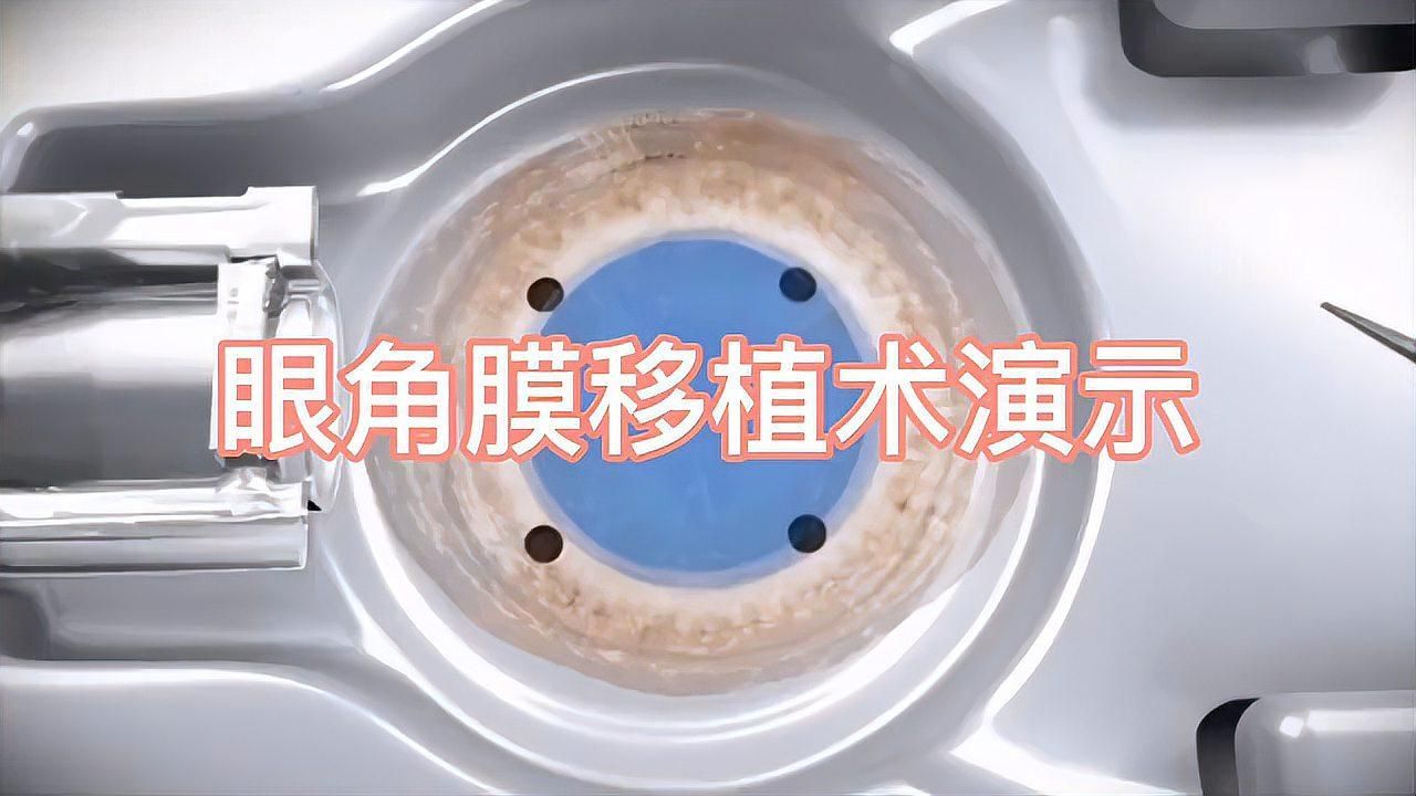 蒙眼病如何治療，百度健康-去問診,