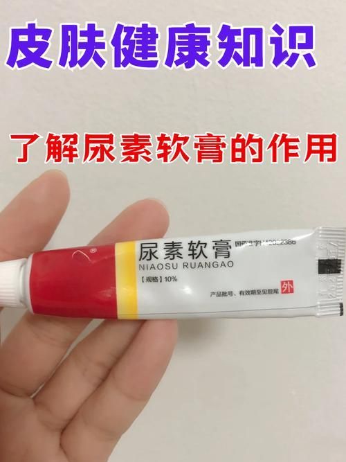有哪些藥物可以預防松鱗病復發，尿素乳膏、乳酸、維a酸、維a酸乳膏、維a酸乳膏、阿維a