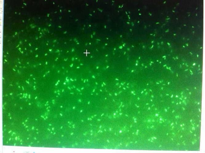 細菌屋清洗后多久會重新菌群，———科學詳解“細菌屋清洗后多久會重新菌群”