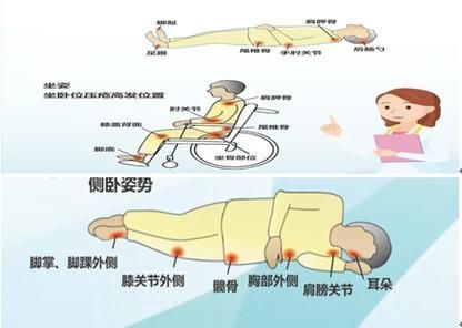非感染性爛尾如何護理，“非感染性爛尾”如何護理
