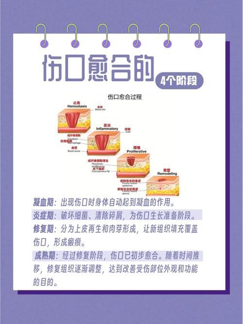 非感染性爛尾如何護理，“非感染性爛尾”如何護理