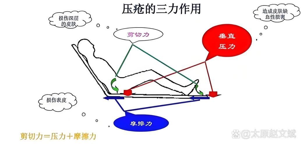 非感染性爛尾如何護理，“非感染性爛尾”如何護理