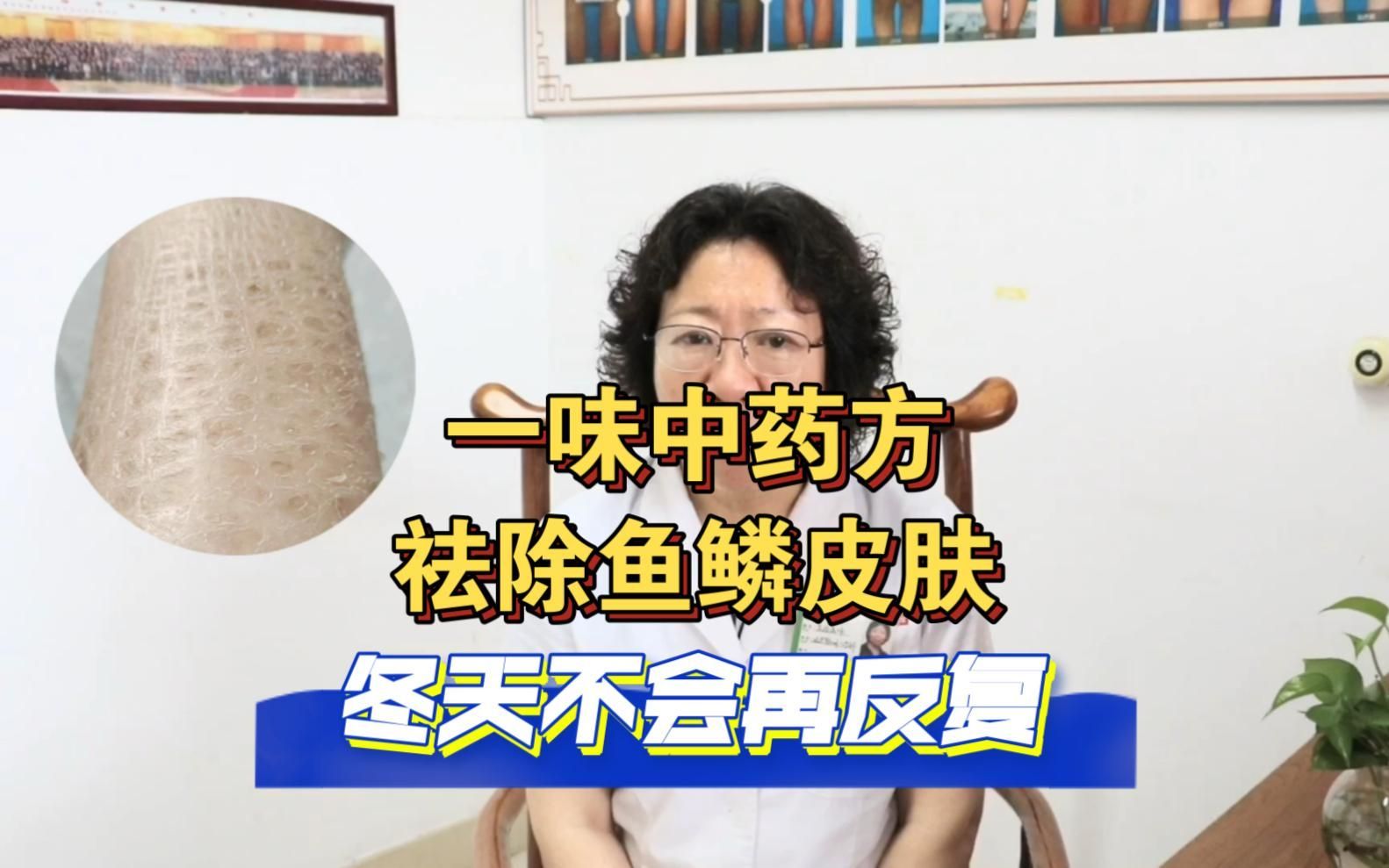 有哪些中藥可以輔助治療立鱗病，中醫治療立鱗病的方法