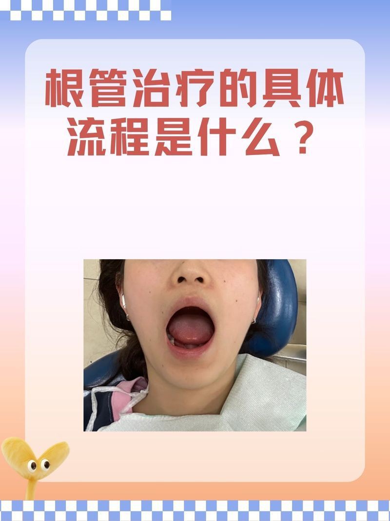 有沒有更詳細的治療步驟？：權威醫生專家意見以下是綜合多個高可信度來源整理的根管治療步驟 有沒有更詳細的治療步驟？：權威醫生專家意見以下是綜合多個高可信度來源整理的根管治療步驟 龍魚百科 第4張