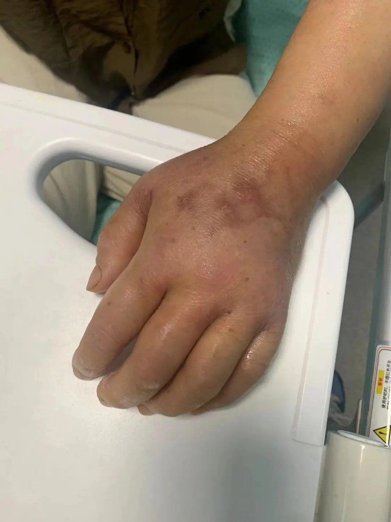 海水魚細菌感染的死亡率有多高?:海水魚因細菌感染導致的死亡率受多重因素影響具有差異性 龍魚百科 第1張 海水魚細菌感染的死亡率有多高?:海水魚因細菌感染導致的死亡率受多重因素影響具有差異性 海水魚細菌感染的死亡率有多高?:海水魚因細菌感染導致的死亡率受多重因素影響具有差異性 龍魚百科 第1張