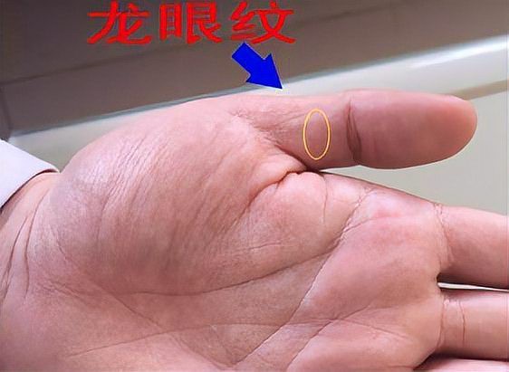 真正的龍眼紋【龍眼紋手相學解析龍眼紋與人體微觀命運的手相特征】