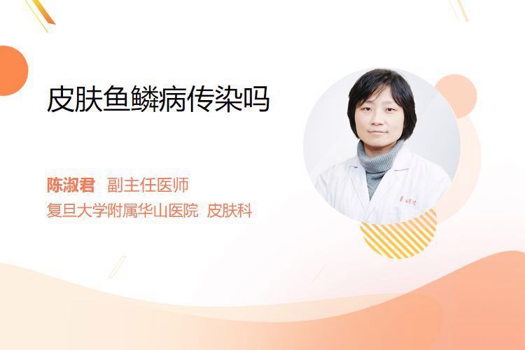 魚鱗變紅滲血會傳染嗎？【魚鱗變紅滲血會傳染嗎王霞副主任醫師三甲魚鱗病會傳染嗎】