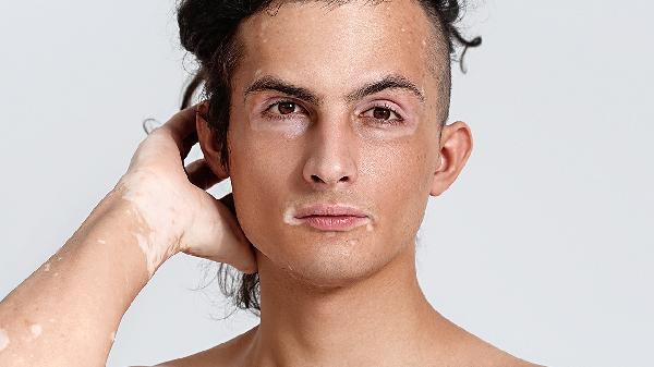 白點病魚怎么治療【《白點病魚怎么治療》】