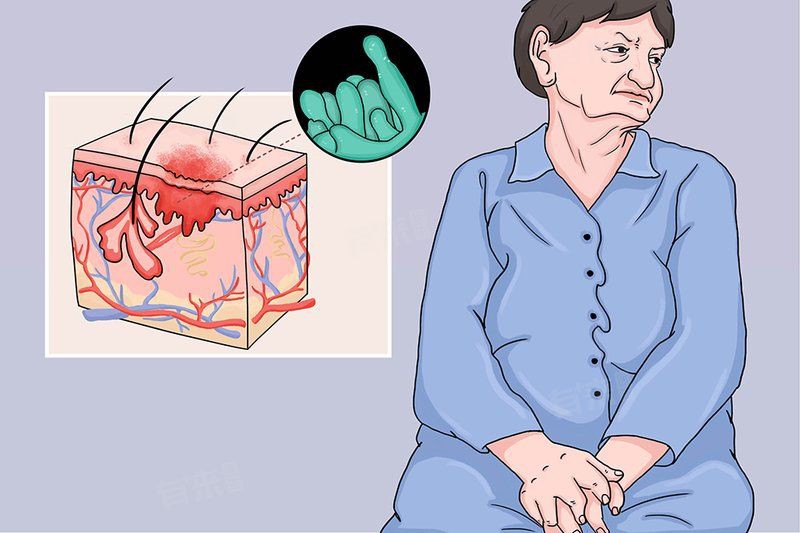 深部真菌感染有哪些常見類型？【什么是深部真菌感染】