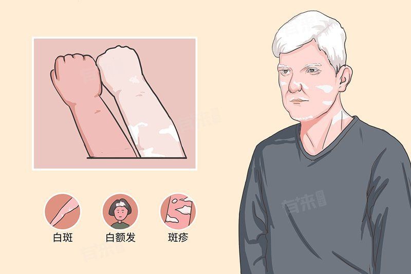 白點病會自愈嗎？【白點病會自愈嗎】