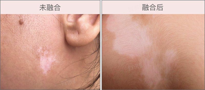 白點(diǎn)病有哪些典型癥狀？，什么是白點(diǎn)病