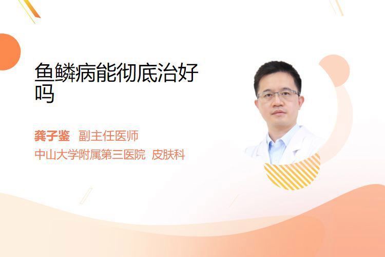 魚鱗病能徹底治愈嗎？，主任醫師三甲,魚鱗病能根治嗎