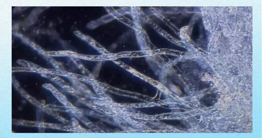 水霉病用高錳酸鉀管用嗎，水產衛士，為什么會得水霉病，如何防治