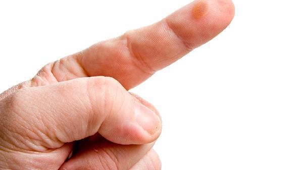 如何判斷龍魚傷口感染是否嚴(yán)重？，養(yǎng)魚小藝，如何判斷龍魚傷口感染的嚴(yán)重程度