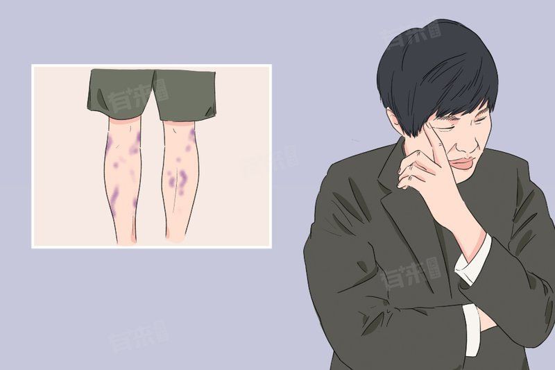真菌在手上如何傳播，手上的真菌感染是怎么引起的 真菌在手上如何傳播，手上的真菌感染是怎么引起的 龍魚百科 第6張