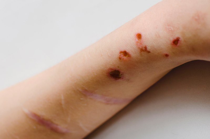 哪些龍魚品種易感染傳染?。浚赘腥緜魅静〉凝堲~品種