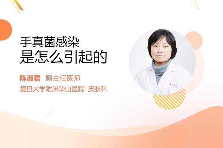 真菌在手上能存活多久，權威醫生專家意見真菌在手上存活時間受多種因素影響