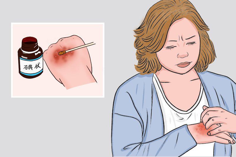 碘伏殘留如何徹底清除？，如何徹底清除碘伏殘留