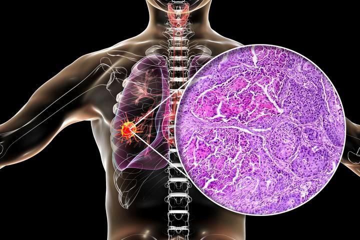 給我一份更詳細的治療方案，不同疾病類型的詳細治療方案