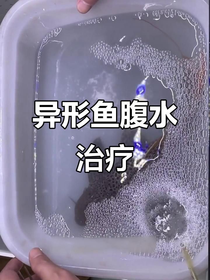 有哪些藥物可以輔助治療魚腹水？，智能模式回答完成調用工具：百度健康治療魚腹水的輔助藥物