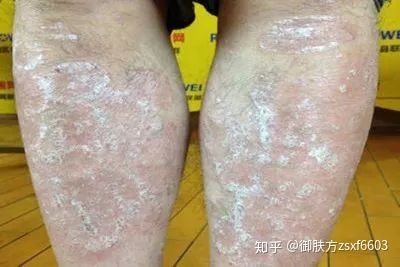 龍魚鱗上有白點為什么：龍魚鱗片上出現白點是怎么回事