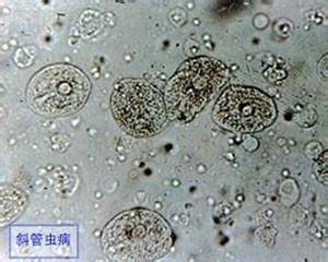 包頭修魚缸電話號碼查詢（ 包頭魚缸批發(fā)市場）