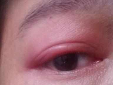 龍魚眼圈發紅什么原因：龍魚眼圈發紅可能是由多種原因引起的，龍魚眼圈發紅什么原因 龍魚眼圈發紅什么原因：龍魚眼圈發紅可能是由多種原因引起的，龍魚眼圈發紅什么原因 龍魚百科 第3張