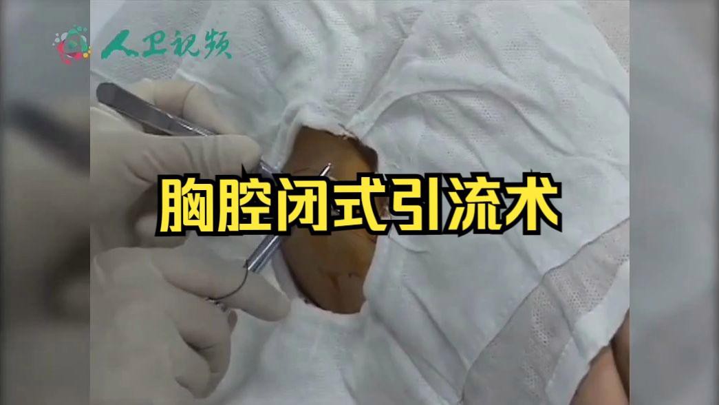 治療期間多久換一次水？ 治療期間多久換一次水？ 龍魚百科 第1張