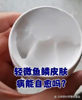 龍魚鱗黑自愈期間需要喂食嗎？ 龍魚鱗黑自愈期間需要喂食嗎？ 龍魚百科 第4張