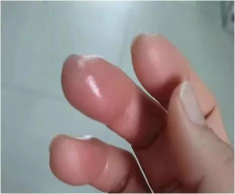 金鼓魚有毒嗎