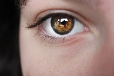 黃金眼鏡蛇雷龍魚(yú)鰭爛了，如何預(yù)防雷龍魚(yú)鰭爛的病因有哪些