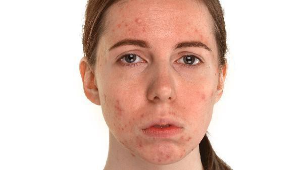 哪些因素會影響紅龍魚鰓蓋發色？