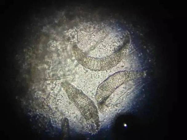 龍魚寄生蟲圖片大全