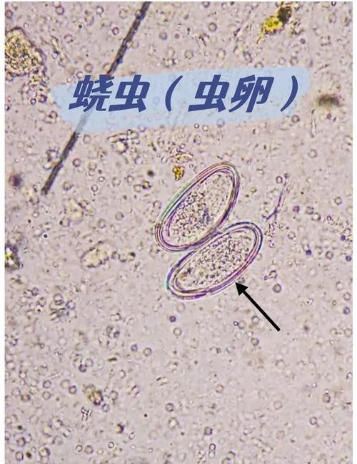 龍魚寄生蟲圖片大全