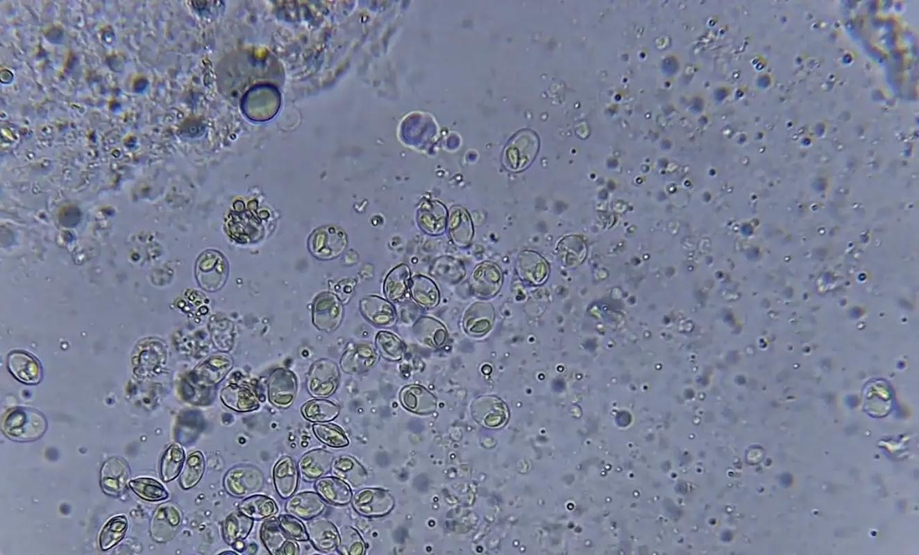 龍魚寄生蟲圖片大全