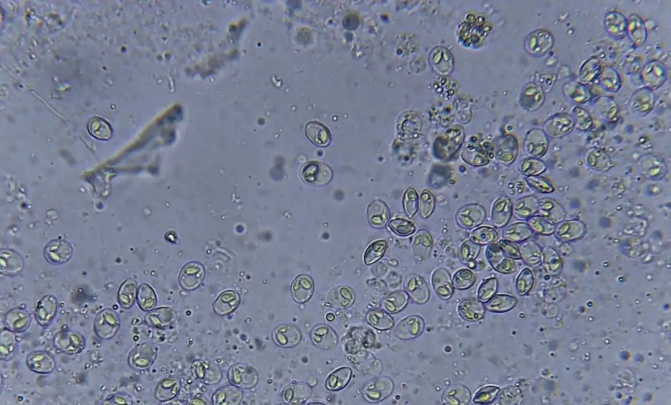 龍魚寄生蟲圖片大全