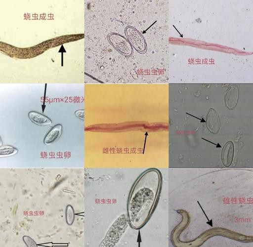 龍魚寄生蟲圖片大全